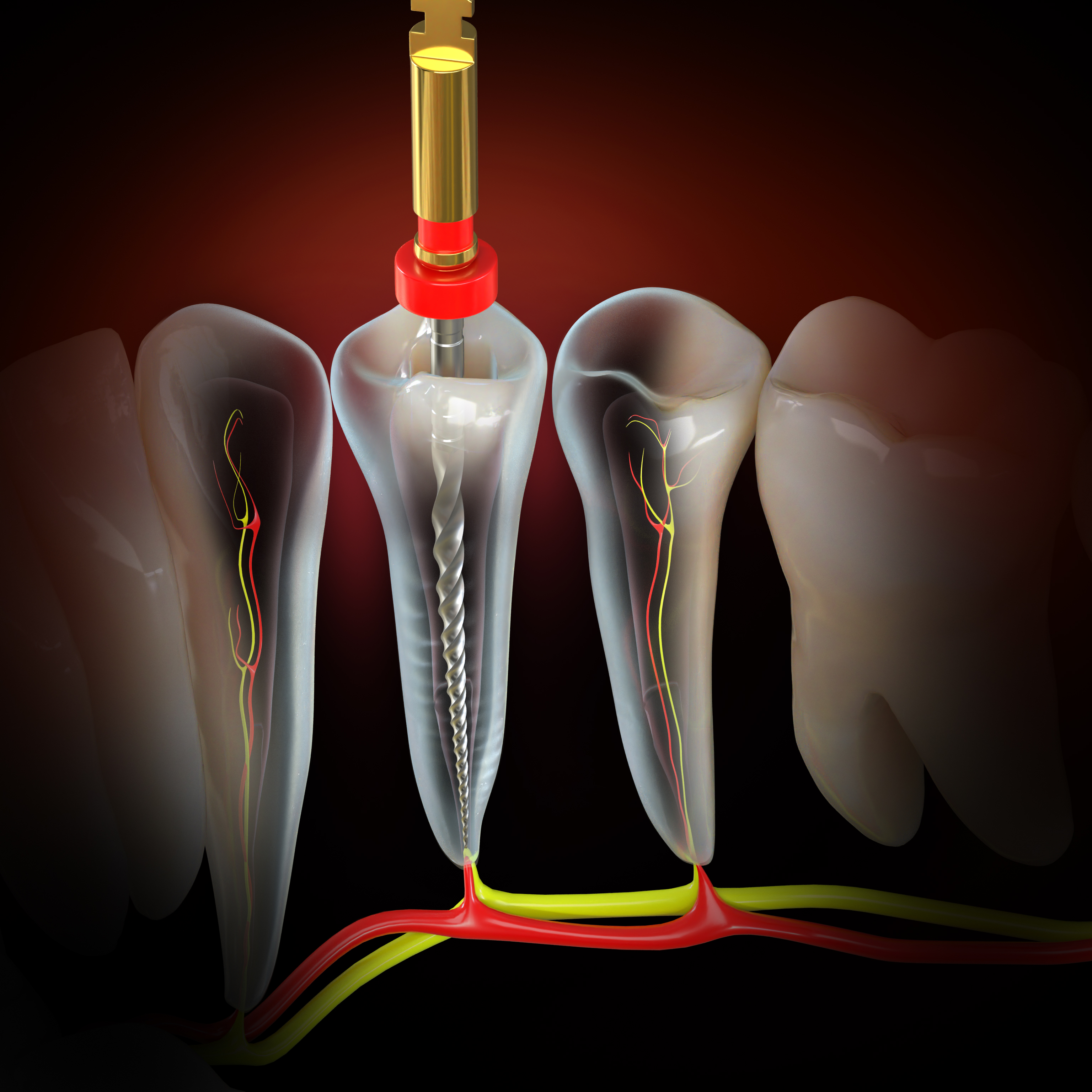Endodontics